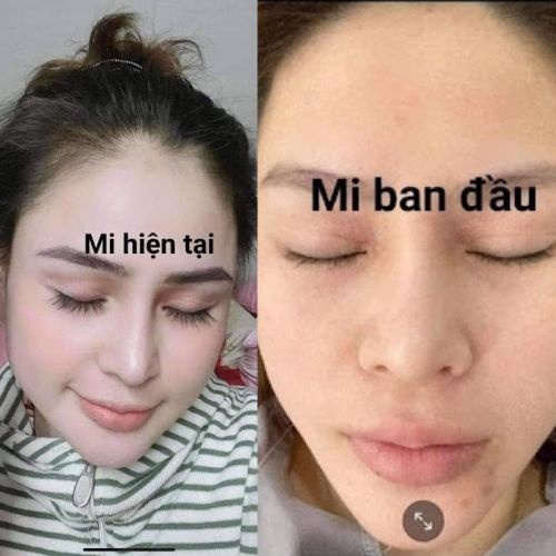 DƯỠNG MI YODY WHITE PHƯƠNG ANH