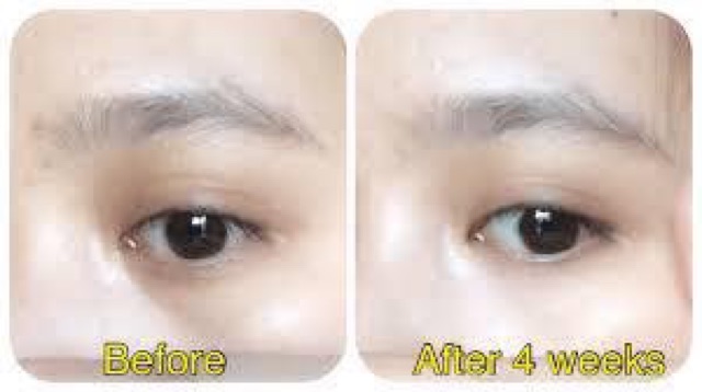 Kem mờ thâm làm sáng da vùng mắt MEISHOKU WHITENING EYES CREAM 30g Nhật Bản | BigBuy360 - bigbuy360.vn