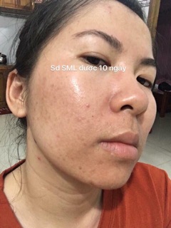 Thuốc đong y sắc mộc lan