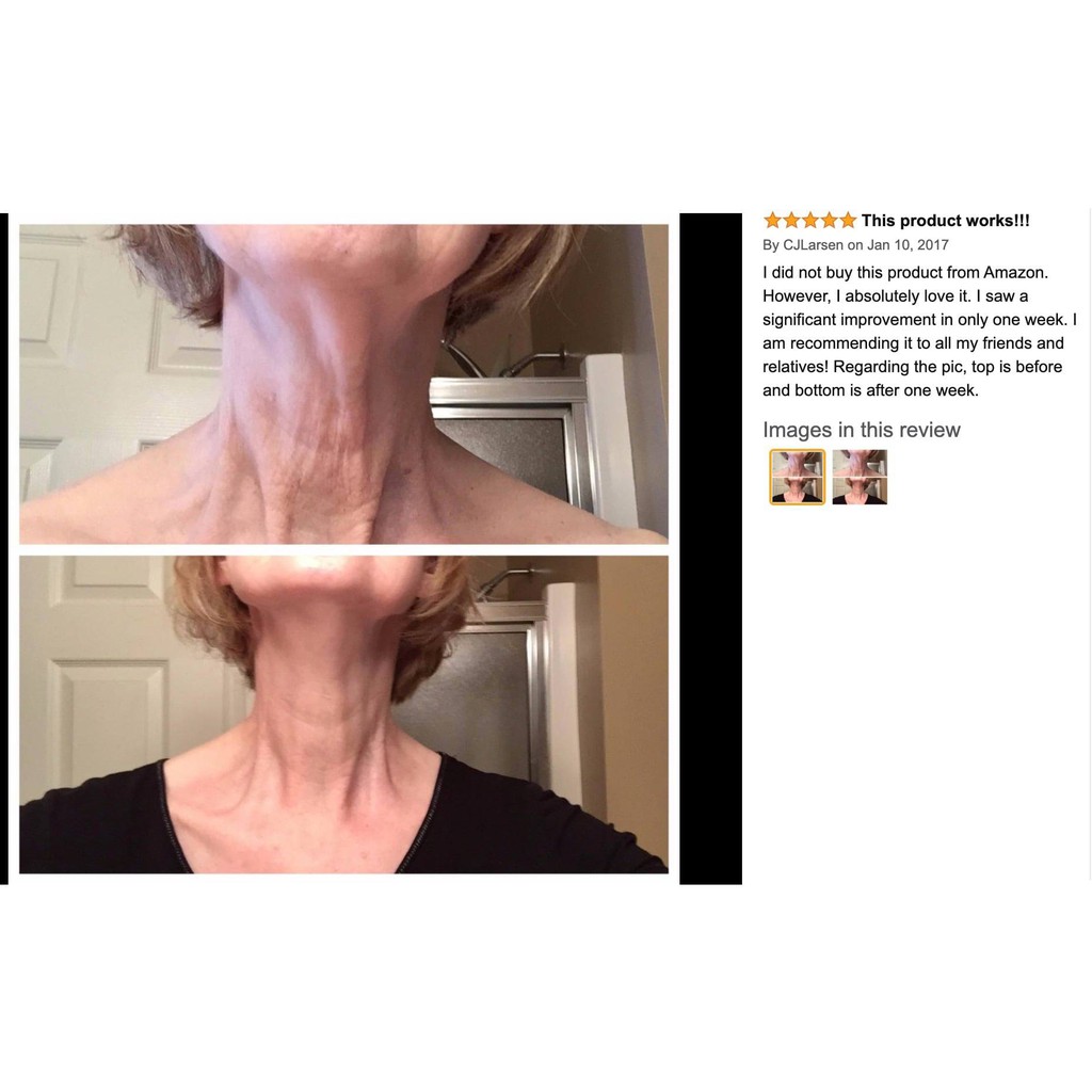 Kem dưỡng cho vùng da cổ và ngực Gold Bond | BigBuy360 - bigbuy360.vn