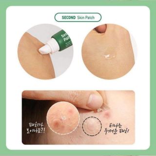 GEL DÁN MỤN SECOND SKIN PATCH PRRETI