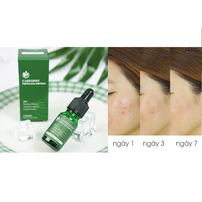 Tinh chất giảm mụn Caryophy Portulaca Ampoule 30ml