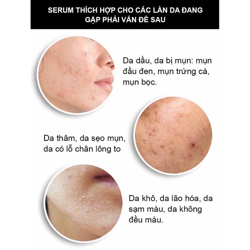 Serum tẩy da chết dưỡng sáng The Ordinary Lactic acid + HA 30ml (AHA)