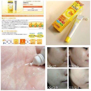 Serum vitamin C menalo CC của Rohto