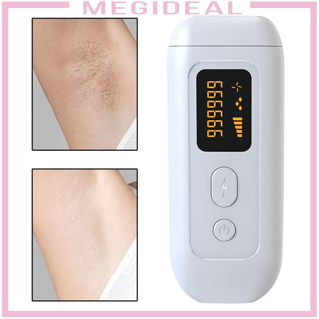 (Hàng Mới Về) Máy Cạo Lông Vĩnh Viễn Bằng Laser 990000 Flashes Phích Cắm Eu | BigBuy360 - bigbuy360.vn