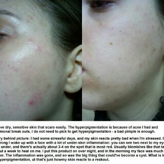 Nước hoa hồng Toner Dickinson's