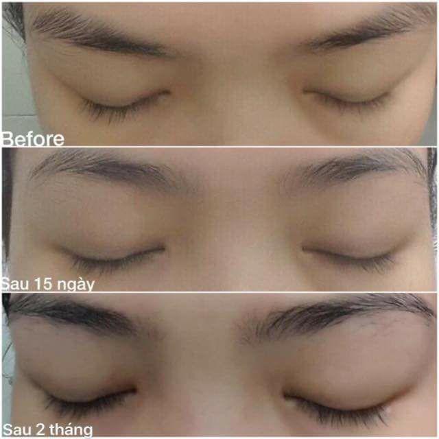 Serum dưỡng dài và dày mi C'Choi | BigBuy360 - bigbuy360.vn