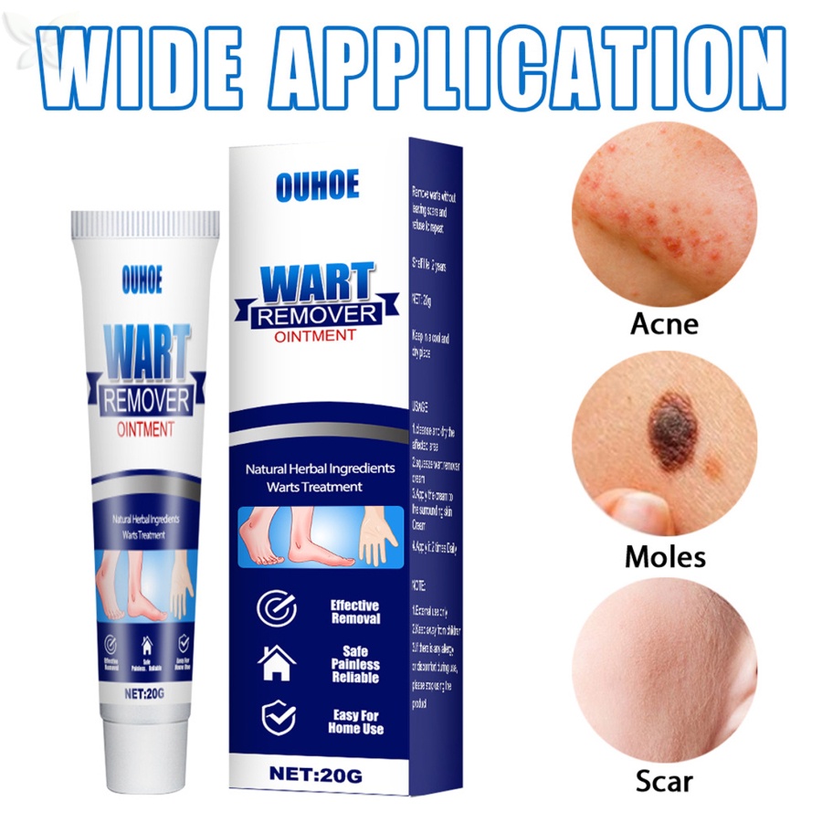 Tuýp Kem Hỗ Trợ Giảm Mụn Cóc Và Đốm Nâu Tự Nhiên 20g JMMZ