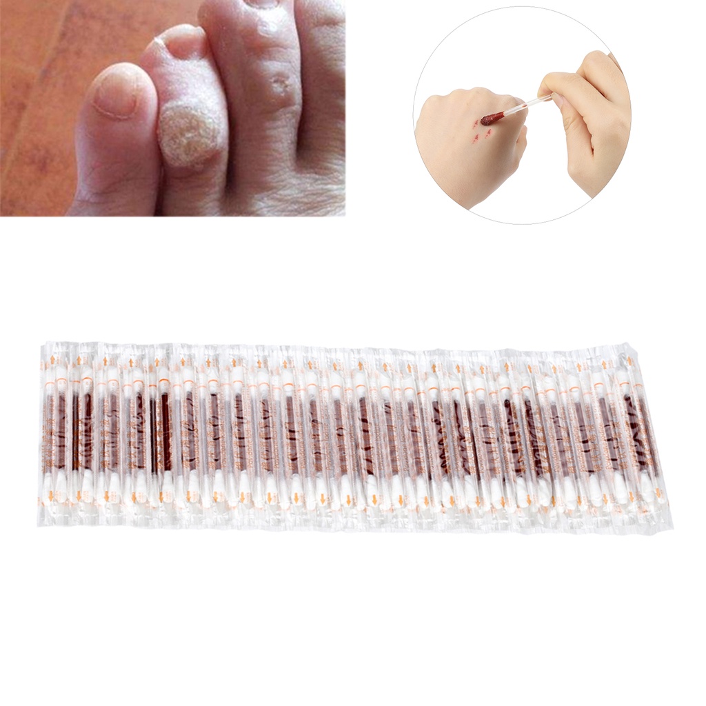 Bộ 50 tăm bông hai đầu có dung dịch sát trùng Iodide dùng vệ sinh vết thương