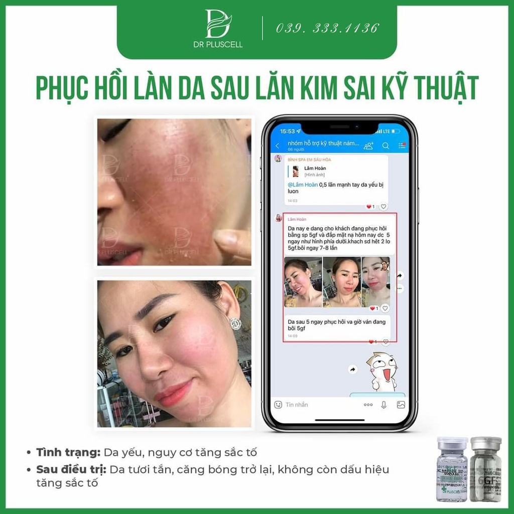 (Mới) Tế Bào Gốc 6GF Dr Pluscell giúp loại bỏ sẹo rỗ,nâng cơ,trẻ hóa và sáng da...