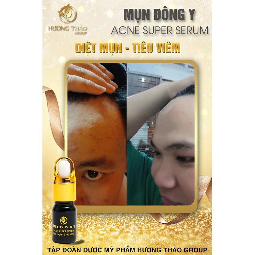 Serum  Mụn Đông Y, Detox White Acne Super Serum