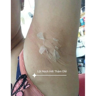 Lột Thay Da Nách Xóa Thâm Hết Sạm Mịn Da