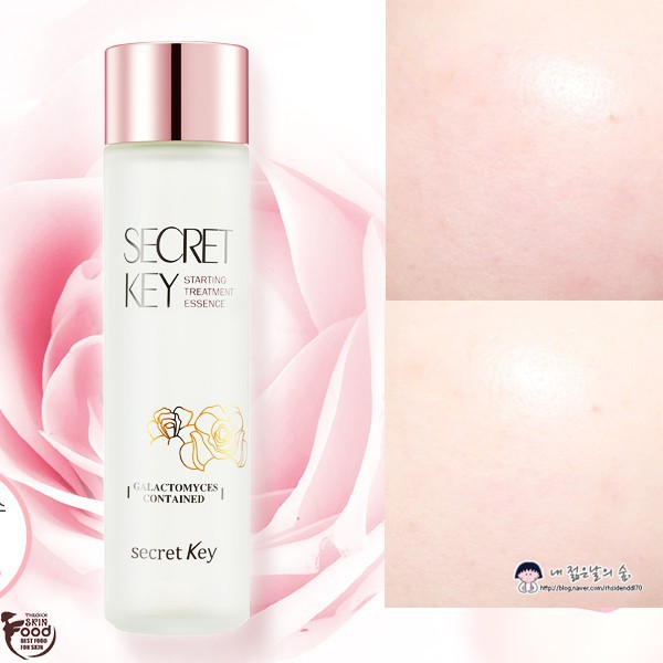 Tinh Chất Dưỡng Trắng Da Chống Lão Hóa Secret Key Starting Treatment Essence (Rose Edition)