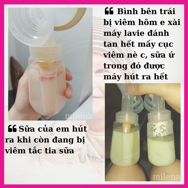 Máy thông tắc tia sữa Lavie thương hiệu Mỹ massage thông tắc tia sữa chữa tắc tia sữa nổi cục hiệu quả
