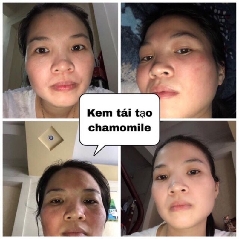 Kem tái tạo Chamomile hồng sâm