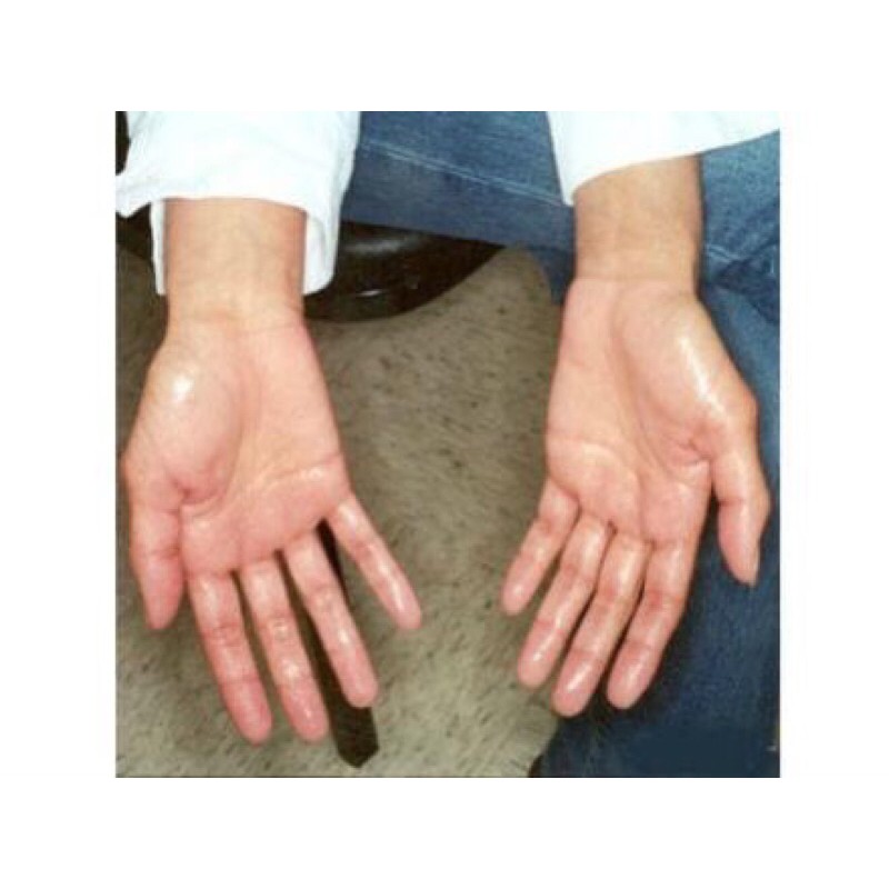 Giảm mồ hôi tay chân từ thảo dược - Defolim - Hộp 30 viên