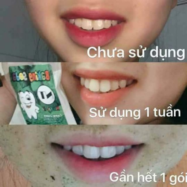 Banking Soda Nt Hương Bạc Hà Chuẩn