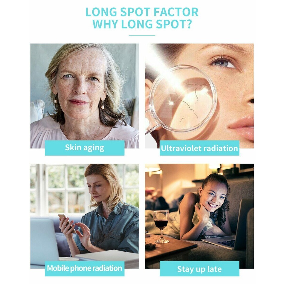 Kem Làm Trắng Và Loại Bỏ Các Hắc Tốt Melanin Và Chăm Sóc Da Trắng Sáng Tự Nhiên Kem Chăm