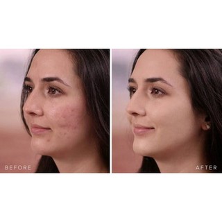Bút che khuyết điểm Kiko