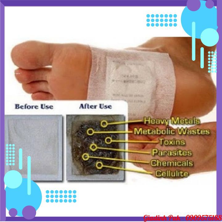 10 Miếng Dán Chân Thải Độc Detox Lanna Foot Patch | BigBuy360 - bigbuy360.vn
