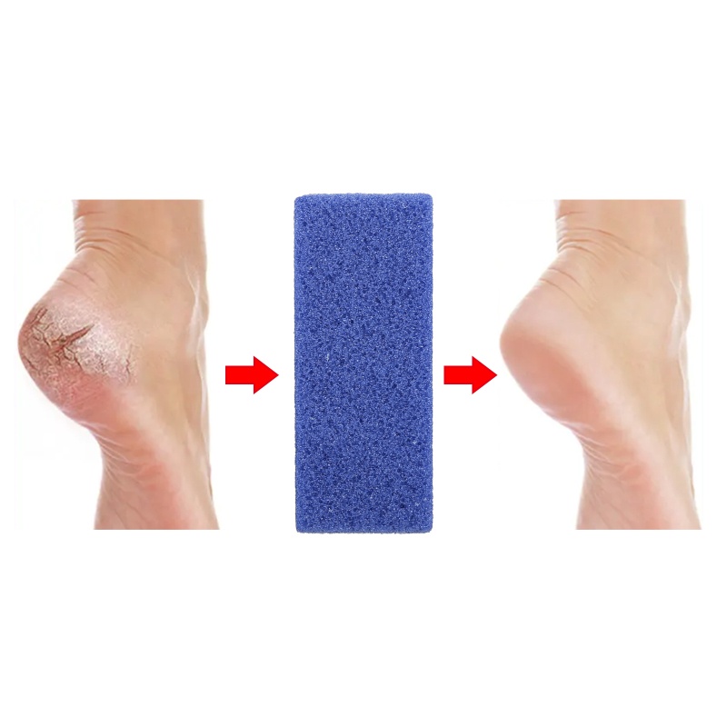 Đá Tẩy Tế Bào Chết Cho Bàn Chân 2 Trong 1 YOUYO