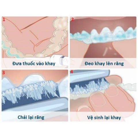 Tẩy trắng răng tại nhà Opalescen chính hãng Ultradent