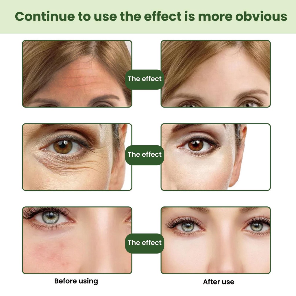 Tinh Chất Retinol Collagen Chống Lão Hóa Loại Bỏ Nếp Nhăn Chăm Sóc Da X0O3