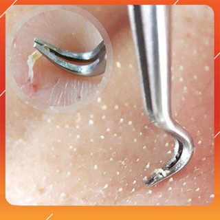 Nhíp gắp mụn thần thánh