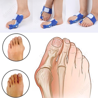 [Hàng mới về] Dụng cụ nẹp chỉnh ngón chân cái an toàn tiện dụng