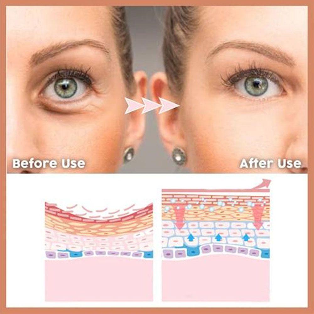 Serum Dưỡng Da Mắt Xóa Mờ Quầng Thâm / Bọng Mắt Hiệu Quả
