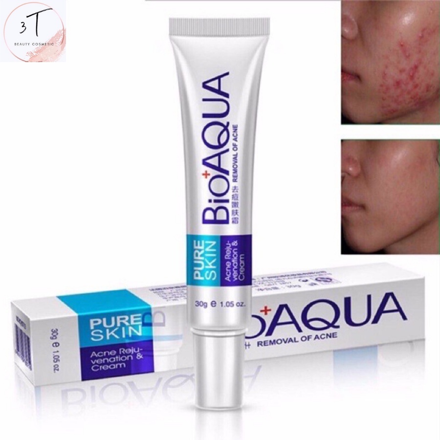 Tuýp kem bôi mụn PURE SKIN CỦA Bioaqua