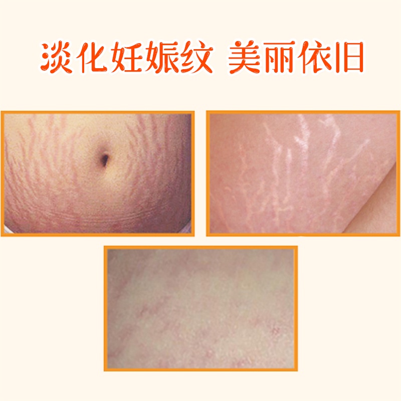 Bio Dầu Chăm Sóc Da Mặt 200ml Tiện Dụng Chất Lượng Cao