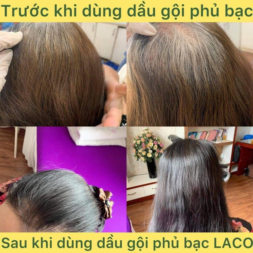 DẦU GỘI PHỦ BẠC LACO