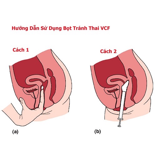 VCF màng phim tránh thai hộp 3 miếng
