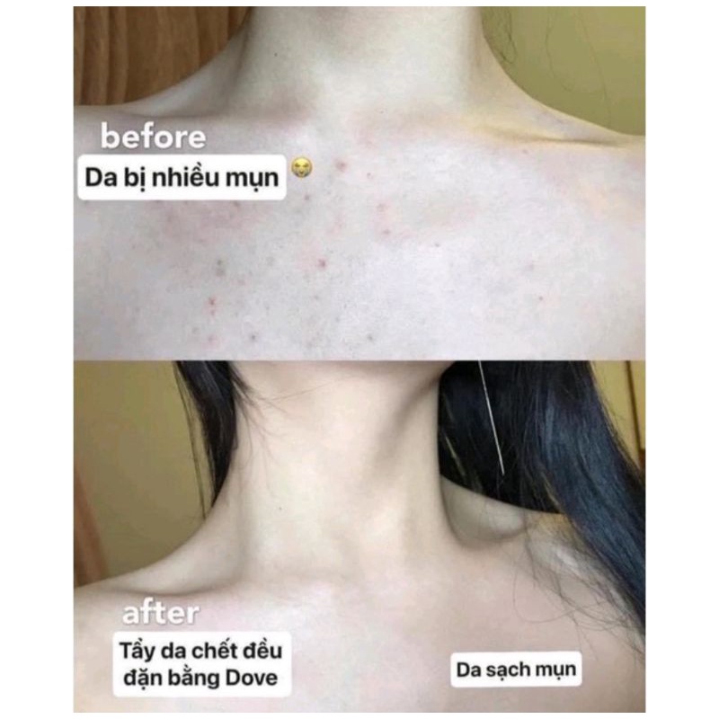 (Đủ bill) Tẩy da chết toàn thân dove body | BigBuy360 - bigbuy360.vn