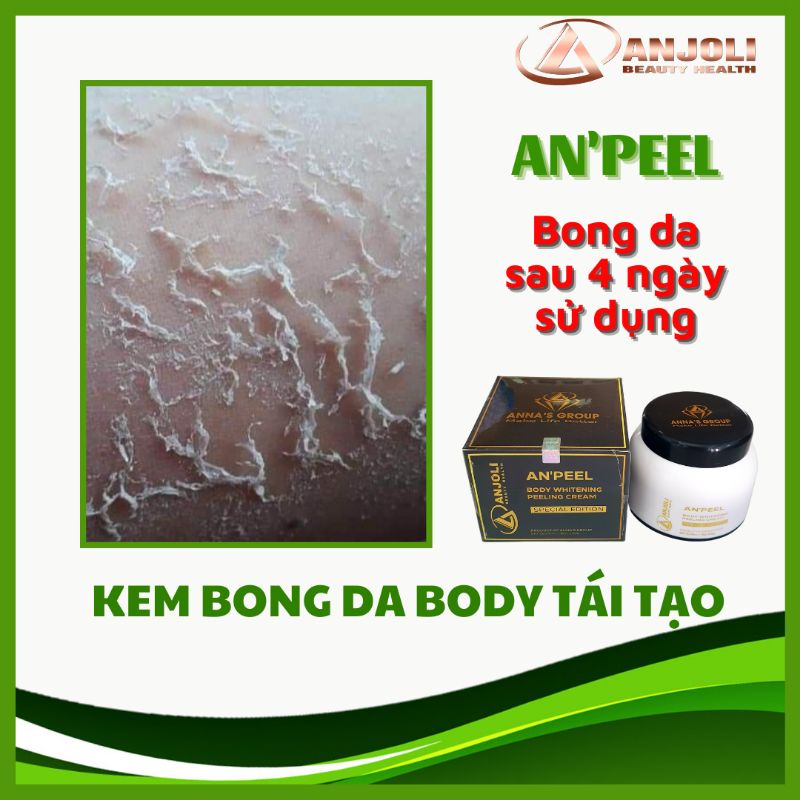 COMBO SỈ 5 KEM BONG DA BODY