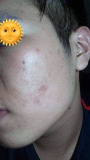 Noãn Thực Vật
