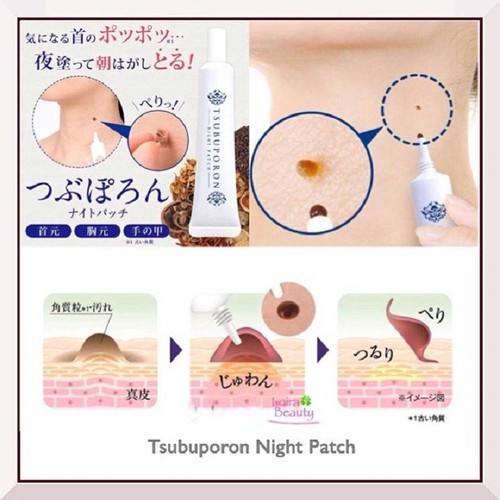 Tinh Chất Bôi Mụn Thịt - Tẩy Nốt Ruồi Tsubuporon Nhật Bản