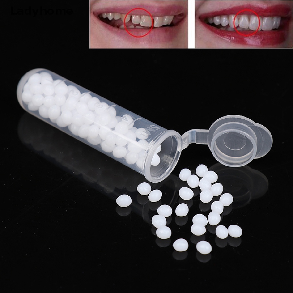 [Hàng mới về] Lọ keo dán cứng sửa chữa răng tạo khoảng cách giả
