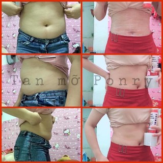 Sỉ 10 combo tan mỡ Ponry