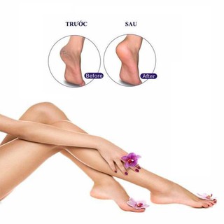 DỤNG CỤ CHÀ GÓT CHÂN BALEA 2 MẶT