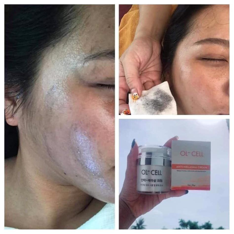 có hạt masage - CHÍNH HÃNG 100% - KEM HÚT NÁM TÀN NHANG OL – CELL CHÍNH HÃNG HÀNG QUỐC | BigBuy360 - bigbuy360.vn