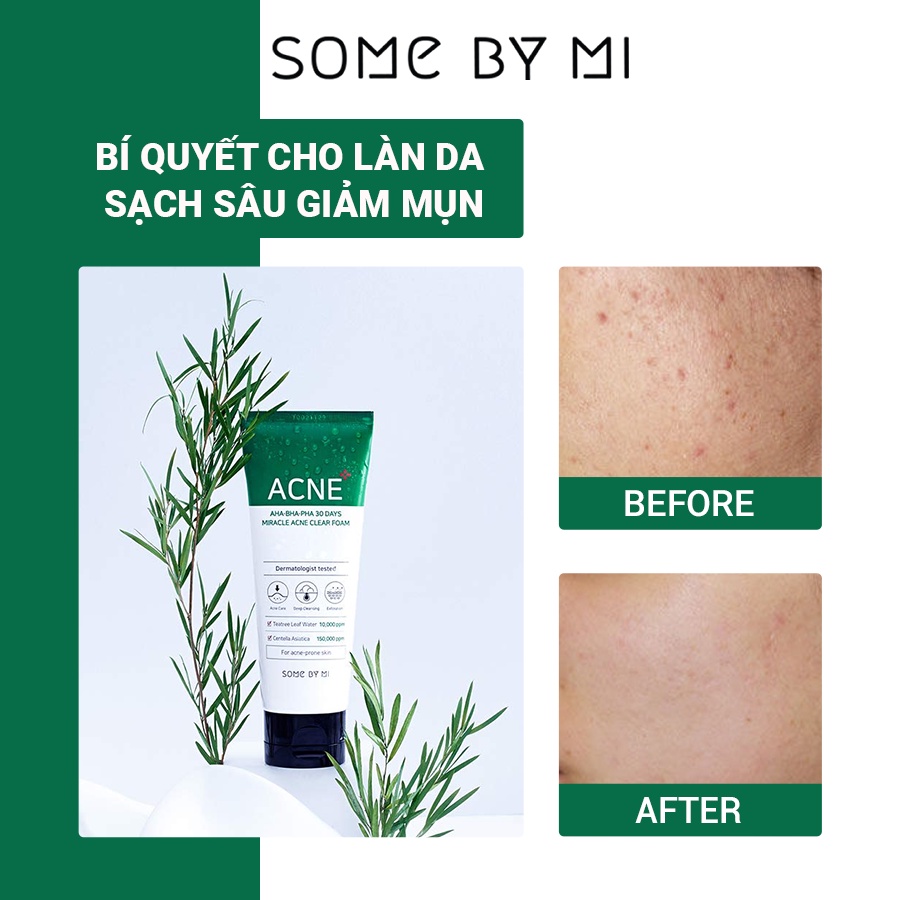 Sữa Rửa Mặt Some By Mi AHA.BHA.PHA 30 Days Miracle Cleansing Foam 100ml