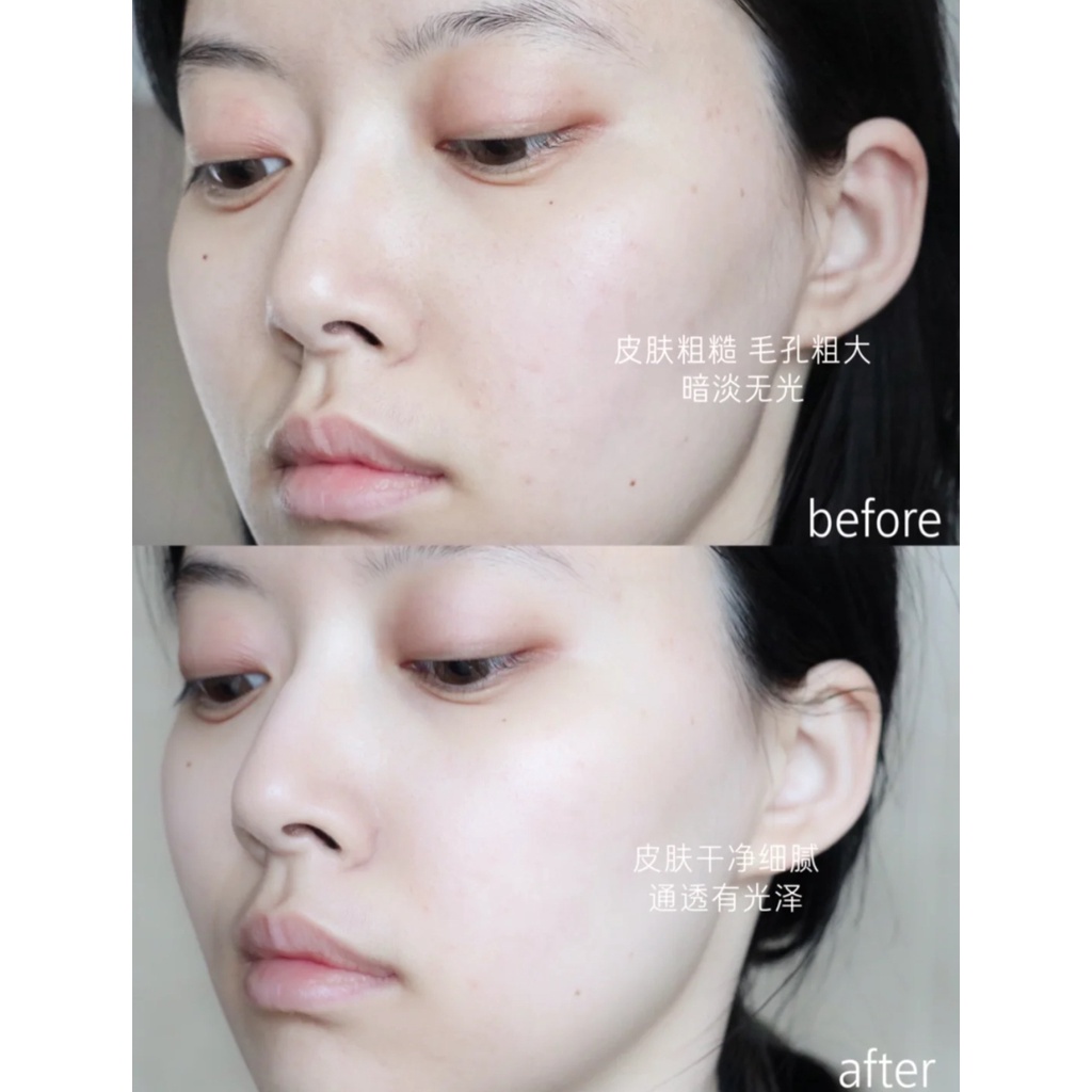 Toner Lancome Aurora Trong Suốt Giữ Ẩm Tẩy Tế Bào Chết Cân Bằng Da 150ml