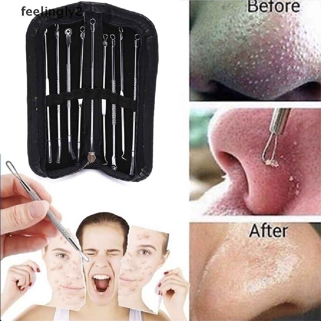 [Hàng mới về] Set 9 dụng cụ nặn mụn đầu đen mụn trứng cá bằng thép không gỉ tiện lợi