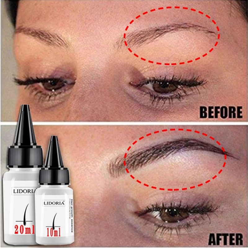 Serum kích thích mọc tóc/lông mày/lông mi chống hư tổn 20ml