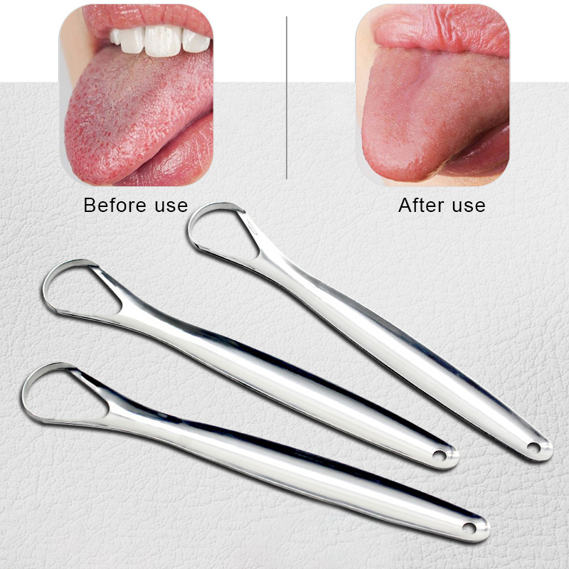 Dụng Cụ Cạo Lưỡi Bằng Thép Không Gỉ Tiện Dụng