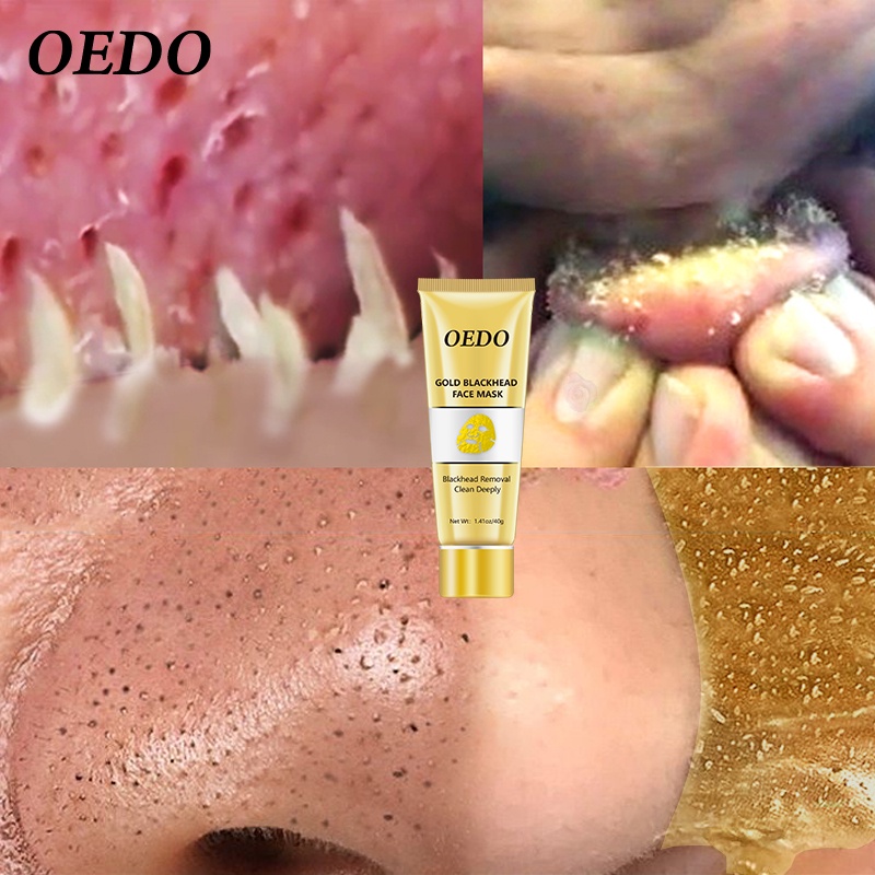 Mặt nạ vàng OEDO Loại Bỏ Mụn Đầu Đen Làm Sạch Sâu Kiểm Soát Dầu Dưỡng Da Hiệu Quả se khít lỗ chân chăm sóc da 40g
