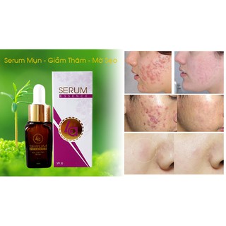 serum LA mụn 10ml