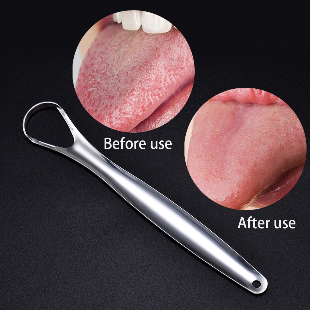 Dụng cụ làm sạch lưỡi bằng inox tiện dụng